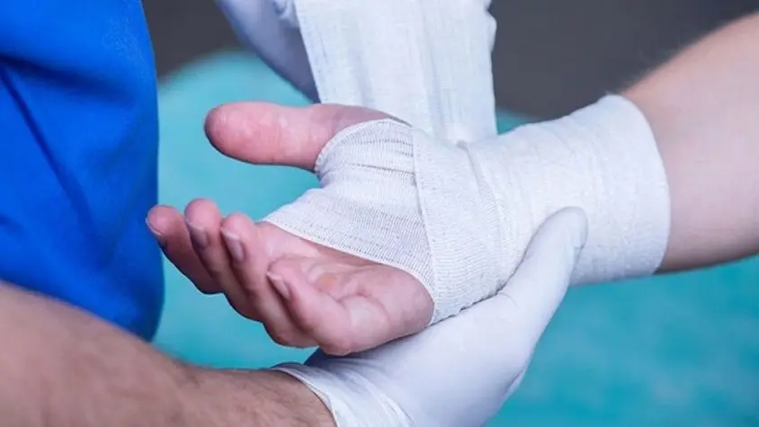 ابتكار طبي: ضمادة ذكية ترصد التهابات الجروح مبكراً