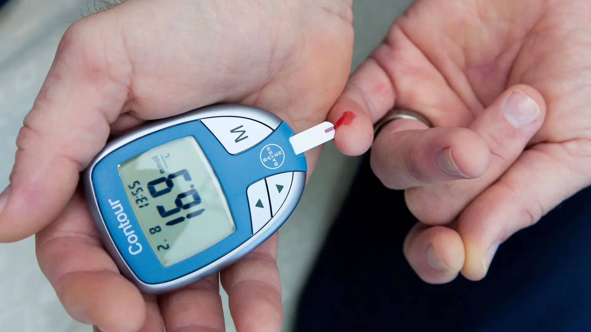 توقعات مقلقة: ارتفاع حاد في إصابات أمراض الكبد بحلول عام 2050، وقد تصل إلى 1.8 مليار شخص